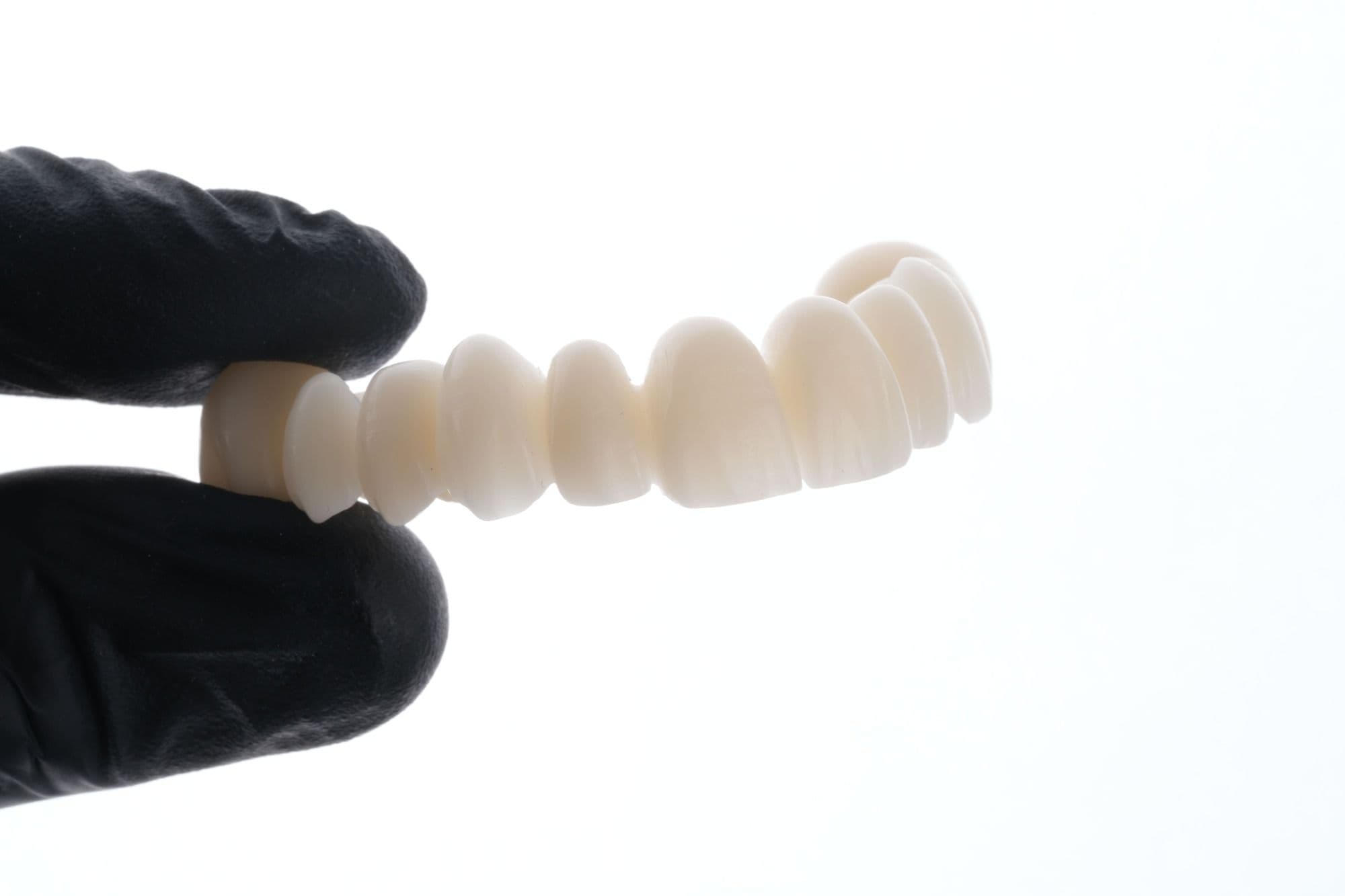 PMMA dental en provisionales: aplicaciones, ventajas y límites